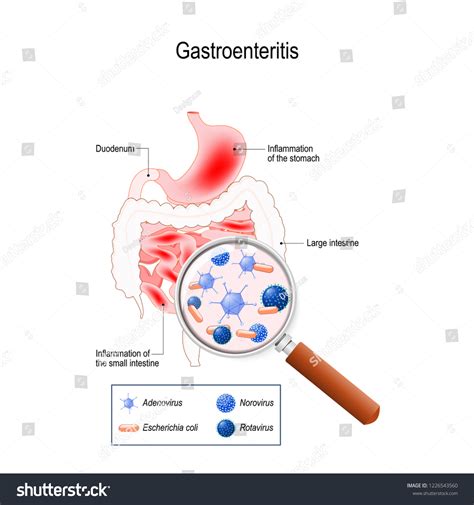 腸胃炎可以吃什麼？讓你的胃腸回春的小祕訣！